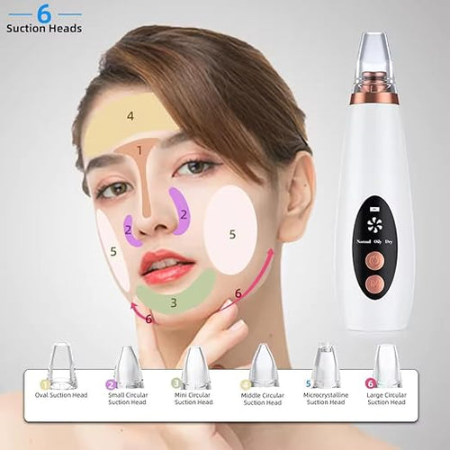 Advanced Blackhead & Whitehead Remover Tool with 6 Suction Heads